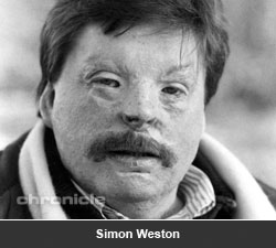 Simon Weston